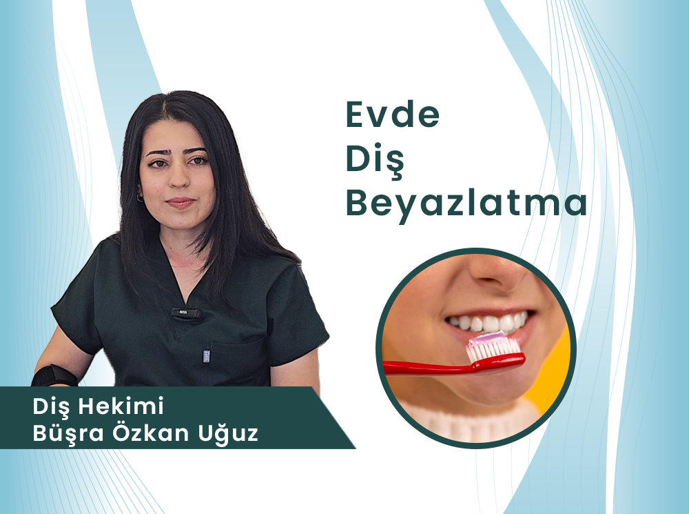 Evde Diş Beyazlatma